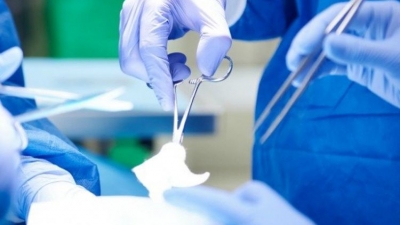 Setelah 20 Tahun, Tumor Otak Terbesar di Dunia Berhasil Diangkat