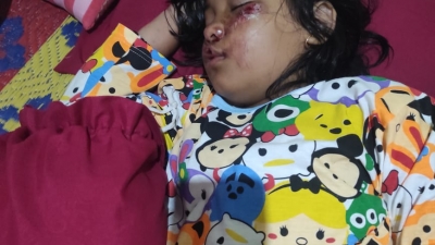 Parah.! Dua Oknum Sat Sabhara Polsek Bahorok diduga lakukan pembiaran terhadap korbank Lakalantas