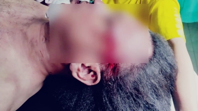 Lembaga Bantuan Hukum (LBH) Medan Desak Polisi Segera Ungkap, Kematian Jurnalis Media Online Nico Saragih